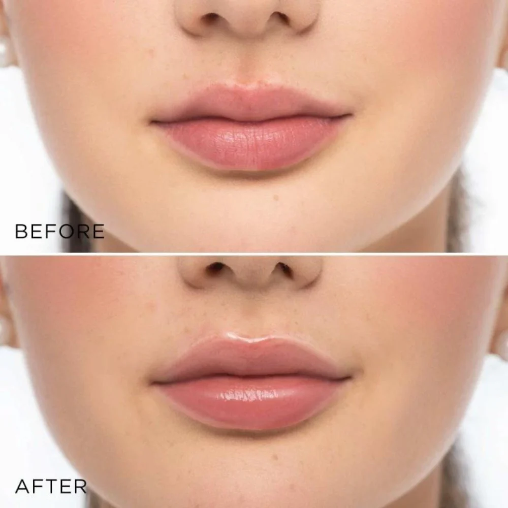 Glossy Lip Volumizer - 6ml - Image 2