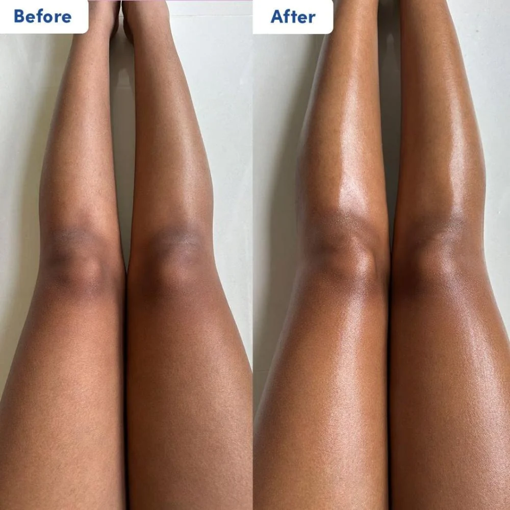 Resurfacing Body Gel Scrub - 170ml - Image 4