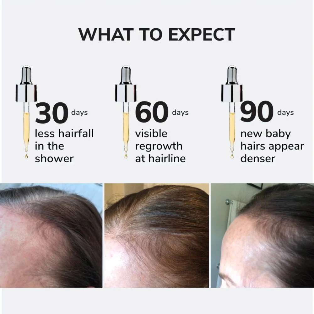 Youth Juice Collagen Scalp Treatment - 50ml - Image 6