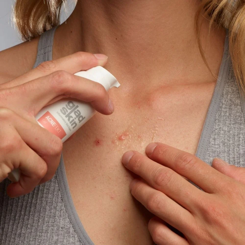 Acnefekt Gel Reduce Acne Symptoms - 30ml - Image 3